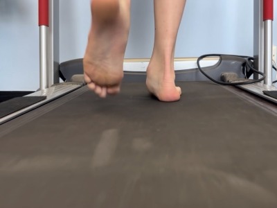Musculoskeletal Podiatry-treadmill