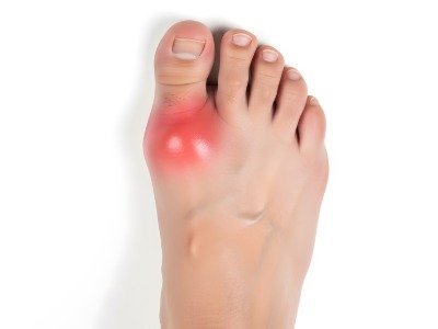 image of Big Toe Joint Pain with red highlighting the pain area