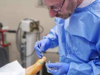 Jonathan Stanley performing ingrowing toenail treatment in Leeds