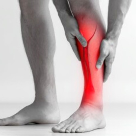 Shin Splints Assessment and Treatment in Leeds hero image