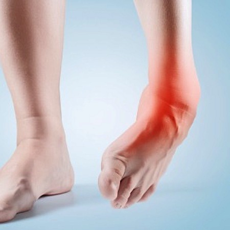 Sprained ankle hero