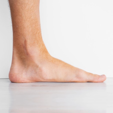 flat foot hero image