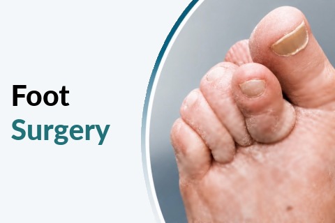 FPC Home Pg Service Foot Surgery