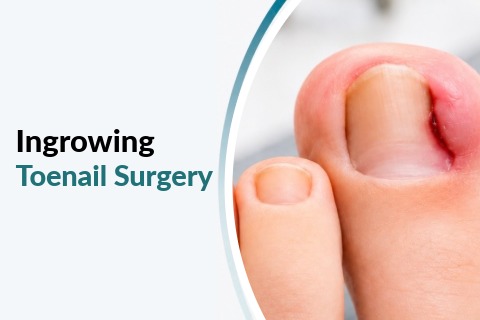 FPC Home Pg Service Ingrowing toe nail