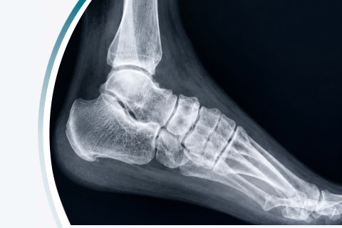 Xray service in leeds