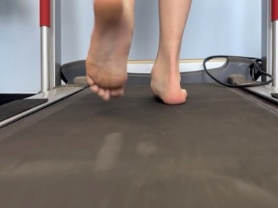 gait analysis on treadmill