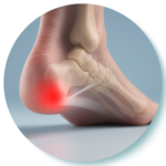 heel pain icon