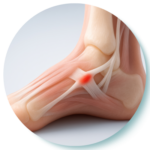 Tendon & Ligament Injuries icon