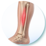 Shin Splints icon