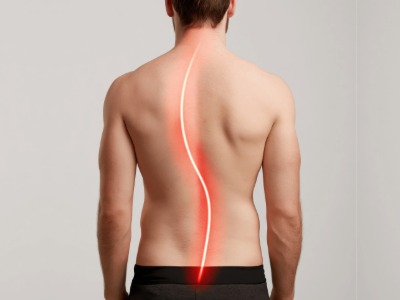 Scoliosis posture correction